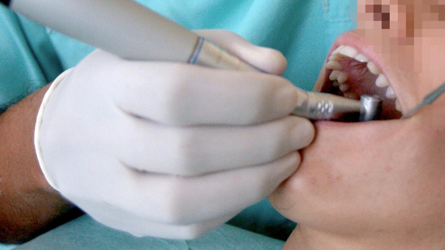 Falso Dentista Denunciato Nei Guai Anche Il Collega In Regola