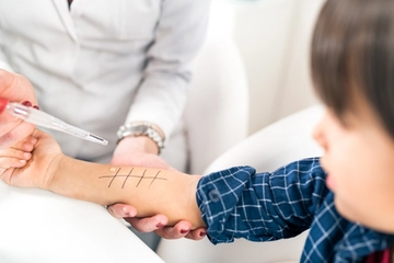 Bologna, allergie gravi: 200 bimbi in attesa dell’immunizzazione