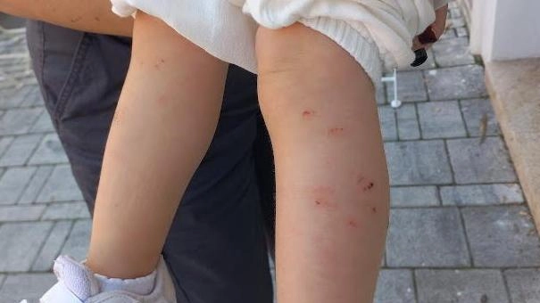 "Troppe zanzare nei parchi". La protesta dei genitori