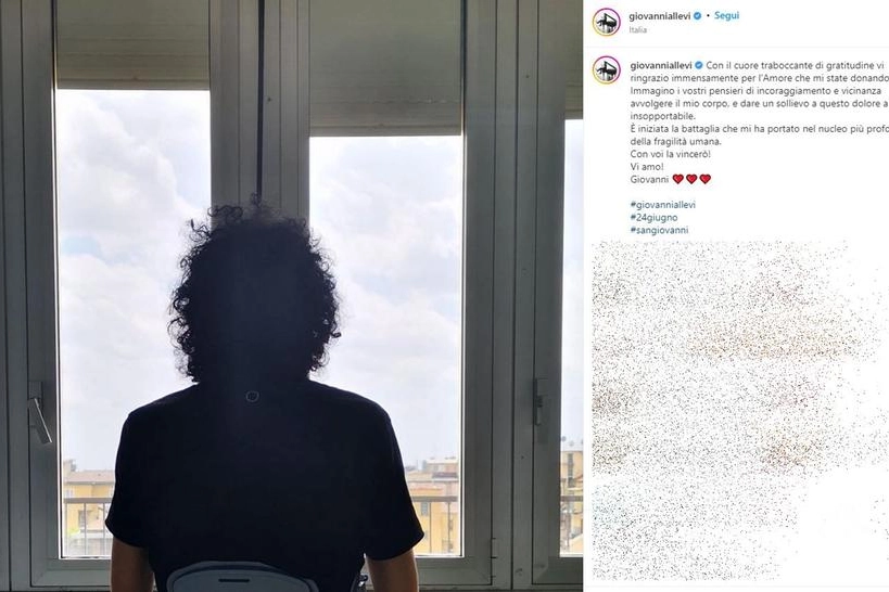 La foto postata da Giovanni Allevi dall'ospedale